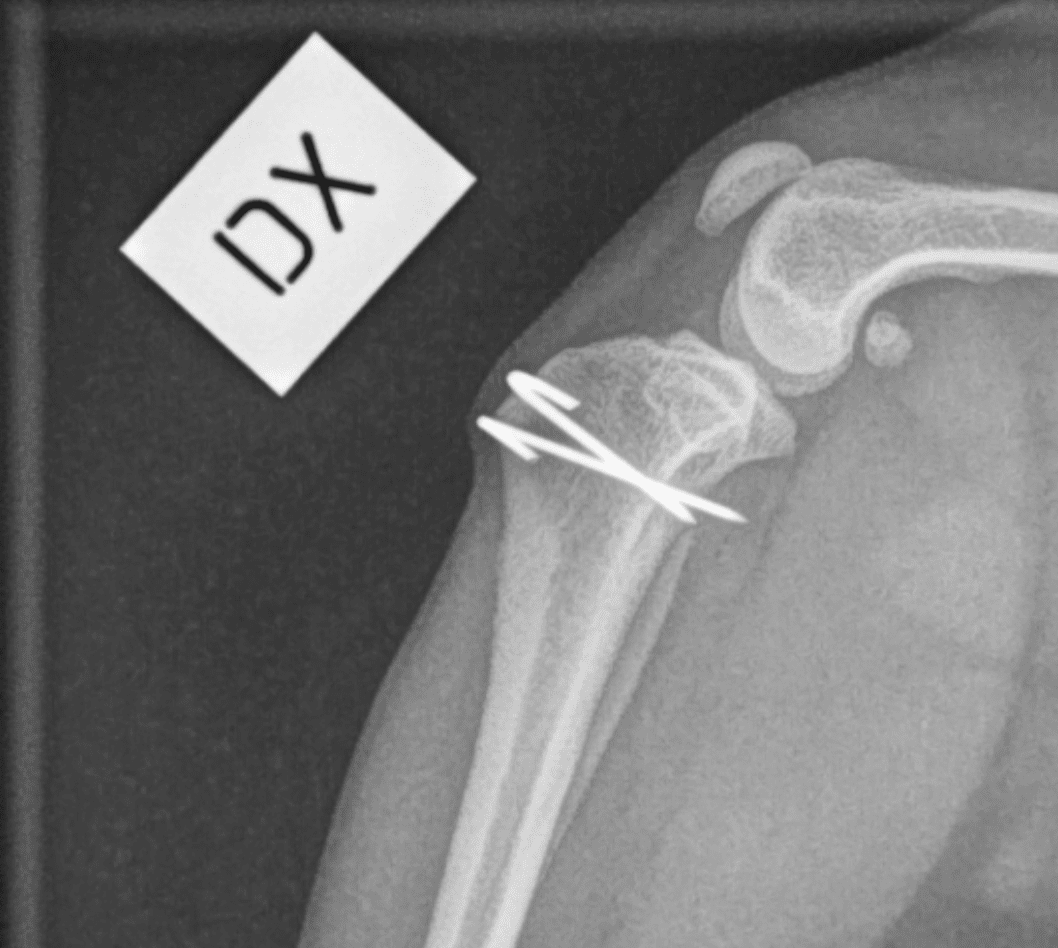 Koiran polvilumpion sijoiltaanmeno